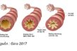Hình minh họa các loại ô nhiễm không khí phổ biến trong nhà như bụi mịn, phấn hoa, nấm mốc, hóa chất