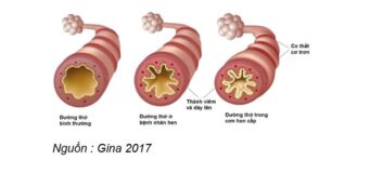 Hình minh họa các loại ô nhiễm không khí phổ biến trong nhà như bụi mịn, phấn hoa, nấm mốc, hóa chất